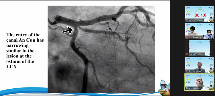 Presentation at the 11th central Vietnam Open Congress of Cardiology